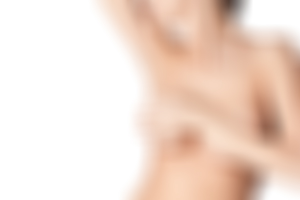 جراحی لیفت سینه