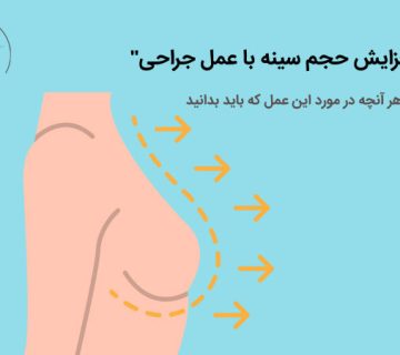 افزایش-حجم-سینه