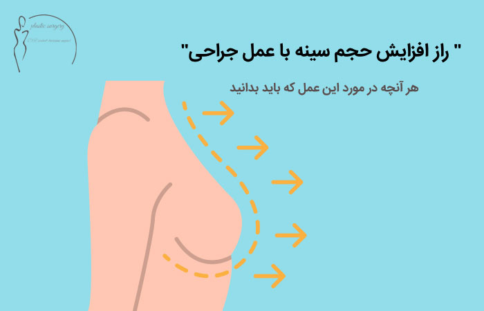 افزایش-حجم-سینه