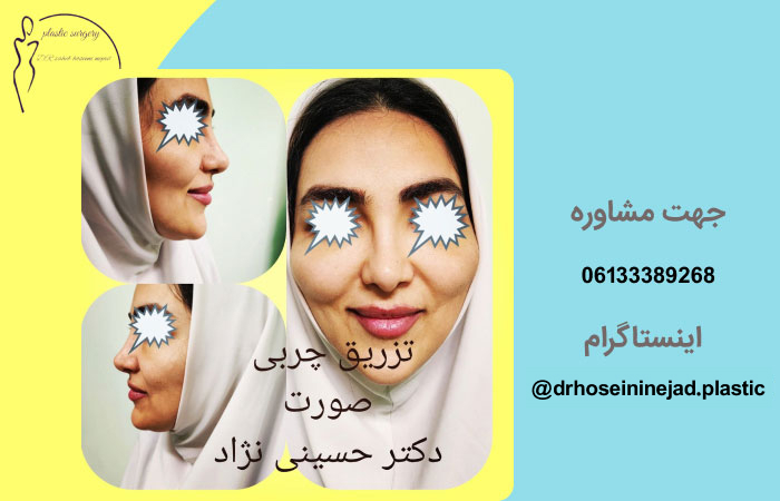 نمونه-کار-دکتر-حسینی نژاد