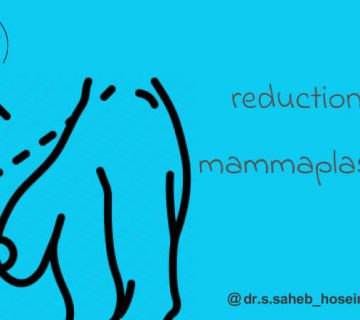 عمل کاهش حجم سینه در اهواز