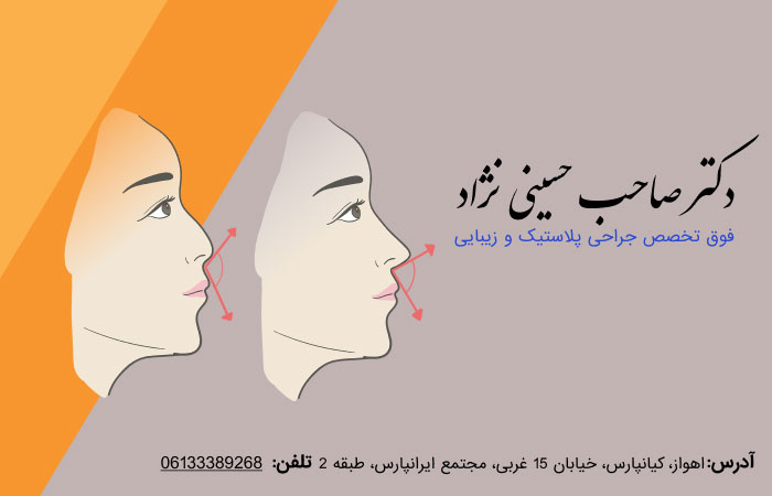 ترمیم-و-اصلاح-فرم-دماغ-با-دکتر-حسینی-نژاد