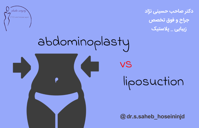 جراحی شکم یا لیپوساکشن