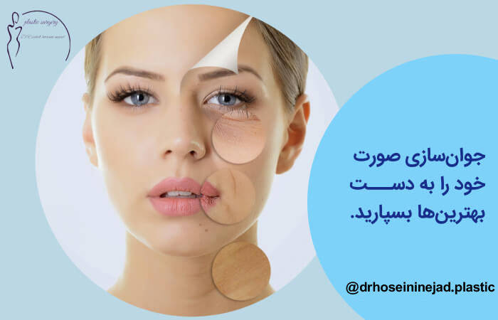 فایده ریتیدکتومی چهره