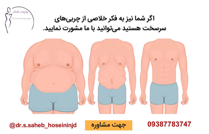 کاهش چربی در آقایان