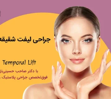 لیفت شقیقه با دکتر صاحب حسینی‌نژاد