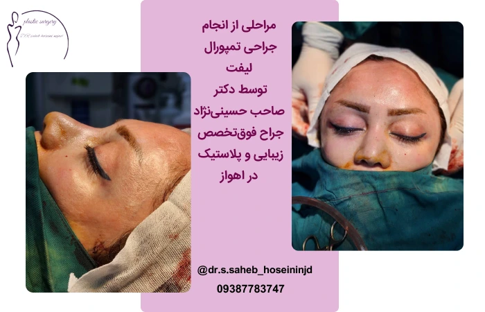 مراحل جراحی تمپورال در اهواز