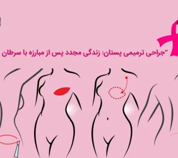 جراحی ترمیمی پستان