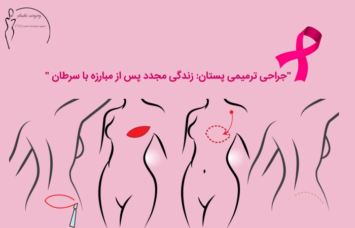 جراحی ترمیمی پستان