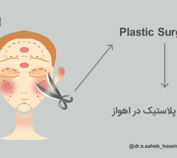 جراحی پلاستیک