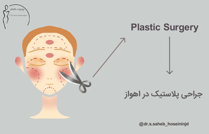 جراحی پلاستیک