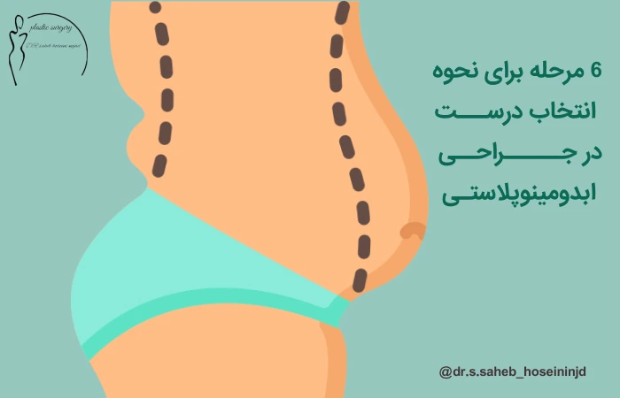 دکتر زیبایی شکم