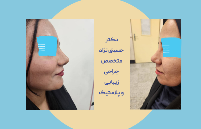 بهترین دکتر زیبایی بینی در اهواز