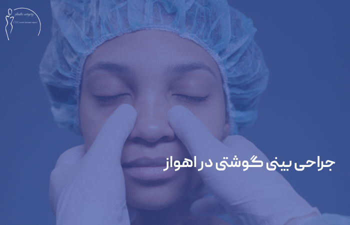 عمل بینی گوشتی در اهواز