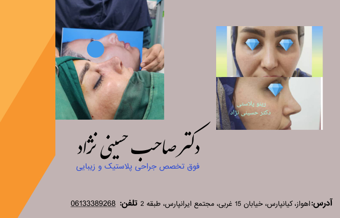 جراحی نچرال بینی در اهواز