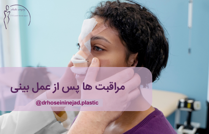 مراقبت ها پس از جراحی بینی