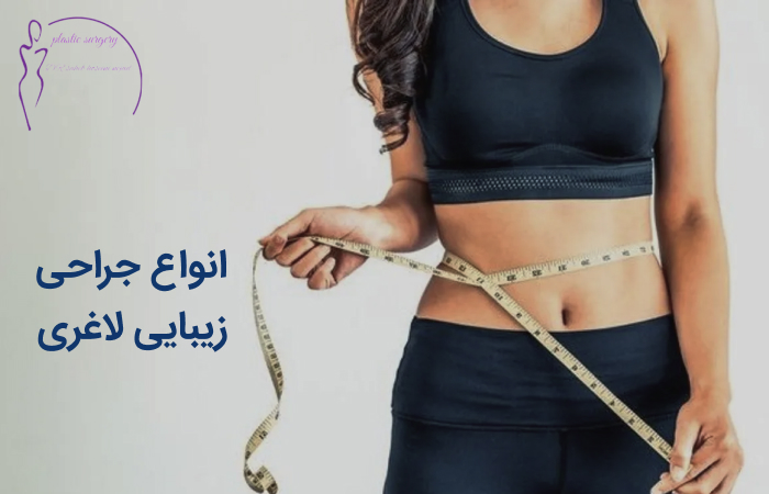 جراحی لاغری در اهواز