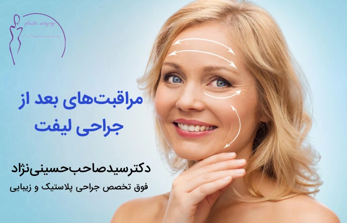 مراقبت های بعد از جراحی لیفت صورت