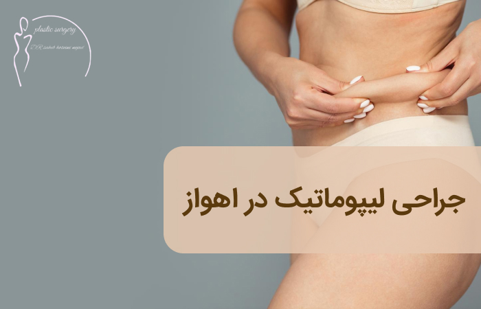 لیپوماتیک