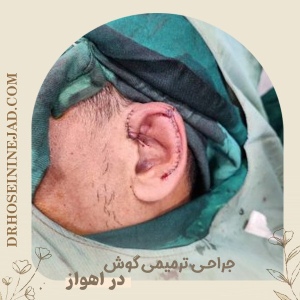 Ear-Reconstruction9