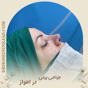 rhinoplasty3