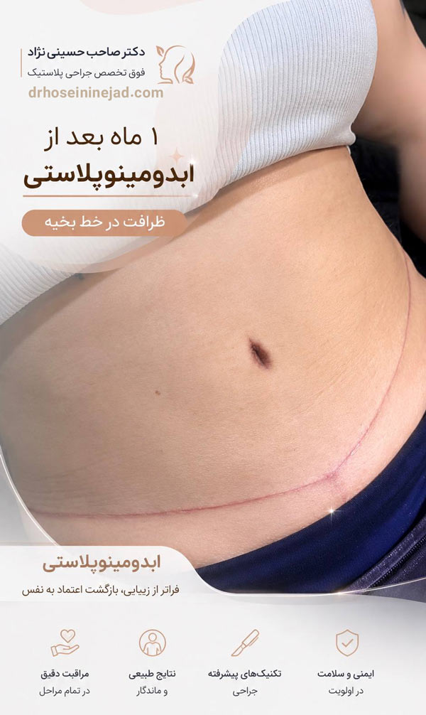 جراح ابدومینوپلاستی - دکتر حسینی نژاد