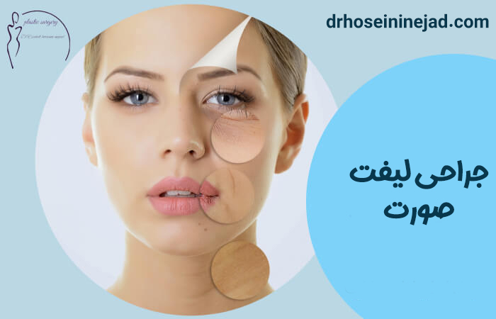جراحی لیفت صورت - دکتر صاحب حسینی نژاد