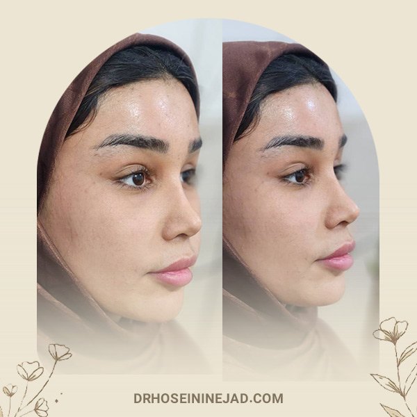 جراح بینی اهواز - دکتر حسینی نژاد