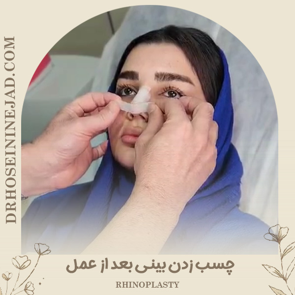 چسب زدن بینی بعد از عمل - دکتر حسینی نژاد