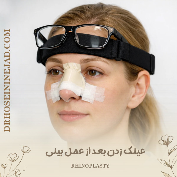 عینک زدن بعد از عمل بینی - دکتر حسینی نژاد