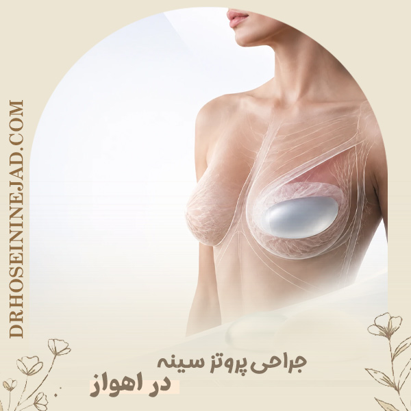 پروتز سینه در اهواز - دکتر حسینی نژاد