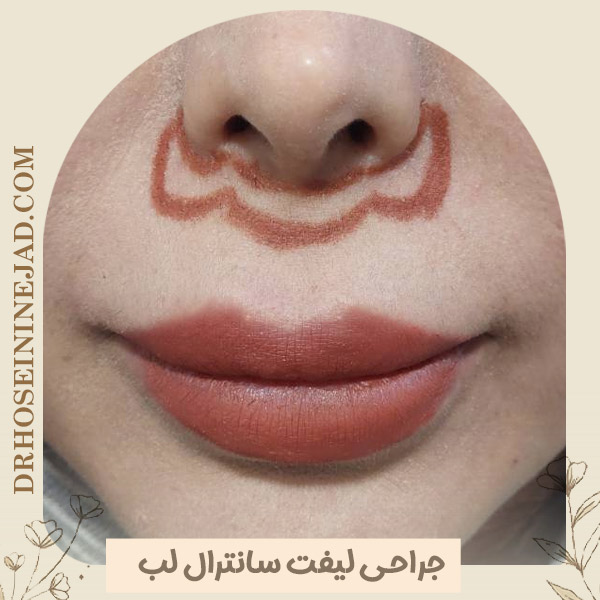 سانترال لب - دکتر حسینی نژاد