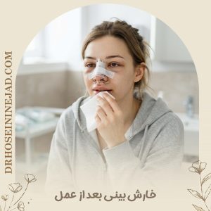 خارش بینی بعد از عمل - دکتر حسینی نژاد