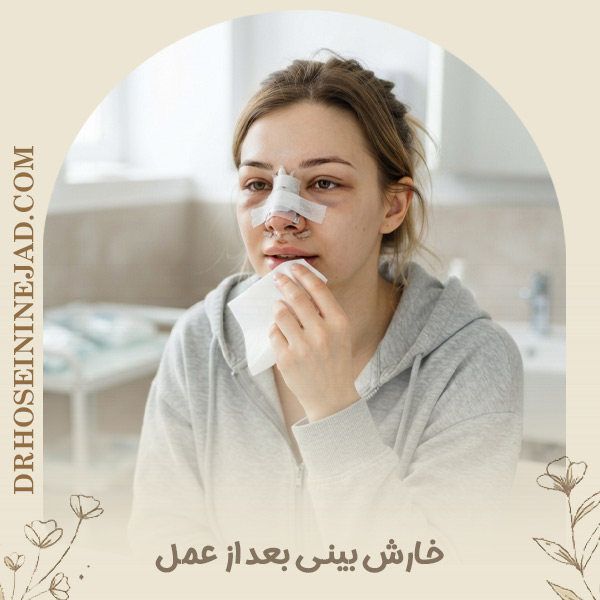 خارش بینی بعد از عمل - دکتر حسینی نژاد