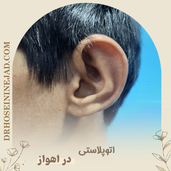 جراحی گوش - دکتر حسینی نژاد