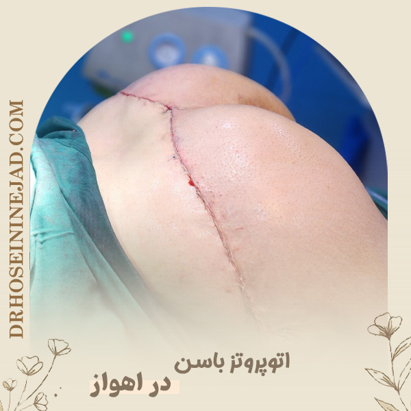 اتوپروتز باسن - دکتر حسینی نژاد