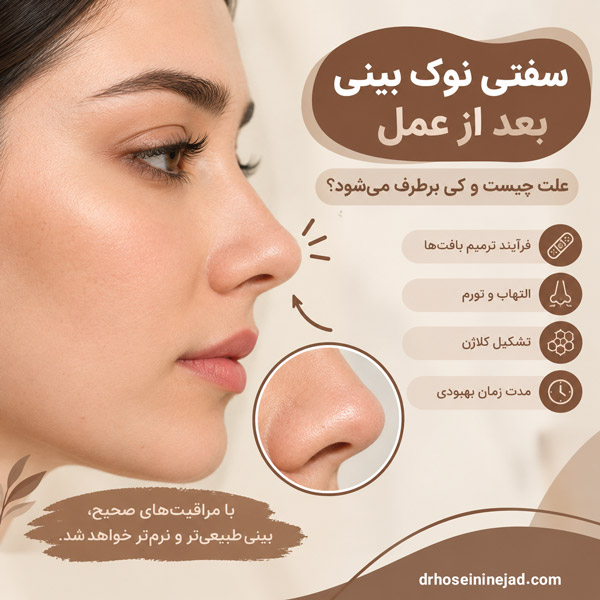سفتی نوک بینی بعد از عمل - دکتر حسینی نژاد